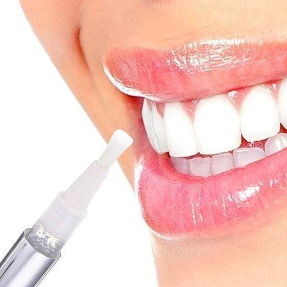 Blanchiment Des Dents