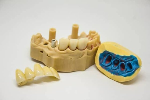 Quelles sont les causes du jaunissement des dents ?